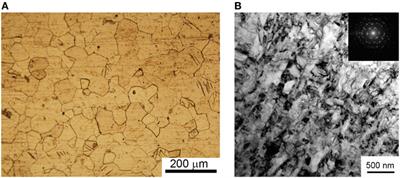 Thin Bioactive Zn Substituted Hydroxyapatite Coating Deposited on Ultrafine-Grained Titanium Substrate: Structure Analysis